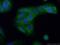 Rhomboid 5 Homolog 2 antibody, 23181-1-AP, Proteintech Group, Immunofluorescence image 