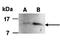 Fibroblast Growth Factor 1 antibody, orb66702, Biorbyt, Western Blot image 