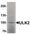 Unc-51 Like Autophagy Activating Kinase 2 antibody, PA5-34543, Invitrogen Antibodies, Western Blot image 