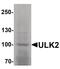 Serine/threonine-protein kinase ULK2 antibody, PA5-34543, Invitrogen Antibodies, Western Blot image 