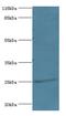 DiGeorge Syndrome Critical Region Gene 6 Like antibody, LS-C372196, Lifespan Biosciences, Western Blot image 