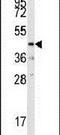 Dual Specificity Phosphatase 10 antibody, PA5-15559, Invitrogen Antibodies, Western Blot image 