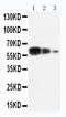ADAM Metallopeptidase Domain 10 antibody, LS-C312693, Lifespan Biosciences, Western Blot image 