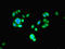Proteasome Subunit Beta 2 antibody, LS-C211111, Lifespan Biosciences, Immunofluorescence image 