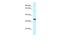 Transmembrane Protein 117 antibody, A18143, Boster Biological Technology, Western Blot image 