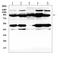 Tyrosine-protein phosphatase non-receptor type 22 antibody, A00581-1, Boster Biological Technology, Western Blot image 