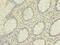 Heterogeneous Nuclear Ribonucleoprotein L antibody, MBS1491998, MyBioSource, Immunohistochemistry frozen image 
