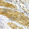 Cyclin Dependent Kinase 6 antibody, A1545, ABclonal Technology, Immunohistochemistry paraffin image 