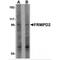 FERM And PDZ Domain Containing 2 antibody, MBS151468, MyBioSource, Western Blot image 