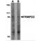 FERM And PDZ Domain Containing 2 antibody, MBS151468, MyBioSource, Western Blot image 