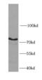 Inhibitor Of Nuclear Factor Kappa B Kinase Subunit Beta antibody, FNab04200, FineTest, Western Blot image 