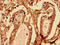 Biglycan antibody, LS-C396237, Lifespan Biosciences, Immunohistochemistry paraffin image 