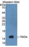 S100 Calcium Binding Protein A9 antibody, LS-C710359, Lifespan Biosciences, Western Blot image 