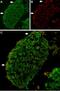 Transient Receptor Potential Cation Channel Subfamily V Member 2 antibody, GTX16610, GeneTex, Immunohistochemistry frozen image 