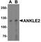 Kiaa0692 antibody, A11367, Boster Biological Technology, Western Blot image 