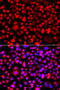 Chitobiosyldiphosphodolichol beta-mannosyltransferase antibody, 23-205, ProSci, Immunofluorescence image 