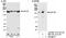 Non-SMC Condensin I Complex Subunit D2 antibody, NB100-1570, Novus Biologicals, Western Blot image 