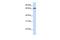 Mediator of RNA polymerase II transcription subunit 26 antibody, GTX49066, GeneTex, Western Blot image 