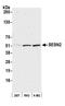 Sestrin-2 antibody, A305-881A-M, Bethyl Labs, Western Blot image 