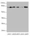 Zinc Finger And BTB Domain Containing 48 antibody, LS-C676730, Lifespan Biosciences, Western Blot image 