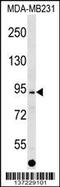 ALS2 C-Terminal Like antibody, 59-294, ProSci, Western Blot image 