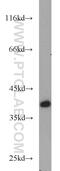 Nudix Hydrolase 9 antibody, 15068-1-AP, Proteintech Group, Western Blot image 