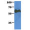 Pyruvate Kinase M1/2 antibody, GTX57604, GeneTex, Western Blot image 