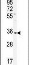 Immunoglobulin Heavy Constant Alpha 1 antibody, PA5-14361, Invitrogen Antibodies, Western Blot image 