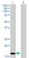 NME/NM23 Nucleoside Diphosphate Kinase 3 antibody, H00004832-M13, Novus Biologicals, Western Blot image 