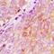 N-Myristoyltransferase 2 antibody, orb412532, Biorbyt, Immunohistochemistry paraffin image 