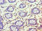 Family With Sequence Similarity 160 Member B1 antibody, LS-C371516, Lifespan Biosciences, Immunohistochemistry paraffin image 
