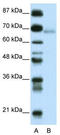 Zinc Finger And BTB Domain Containing 22 antibody, TA339111, Origene, Western Blot image 