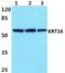 Keratin 16 antibody, A03393S451, Boster Biological Technology, Western Blot image 