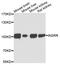 Insulin Receptor Related Receptor antibody, abx136001, Abbexa, Western Blot image 