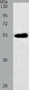Solute Carrier Family 2 Member 3 antibody, TA321793, Origene, Western Blot image 
