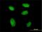 Remodeling And Spacing Factor 1 antibody, H00051773-M05, Novus Biologicals, Immunofluorescence image 