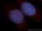 T-Complex 10 Like antibody, 13709-1-AP, Proteintech Group, Immunofluorescence image 