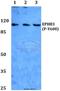 ETK2 antibody, A04659Y608, Boster Biological Technology, Western Blot image 