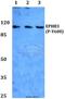 EPH Receptor B3 antibody, A04659Y608, Boster Biological Technology, Western Blot image 