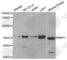 Neuropilin 1 antibody, A6210, ABclonal Technology, Western Blot image 