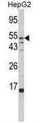 Alpha-L-Fucosidase 1 antibody, AP17405PU-N, Origene, Western Blot image 