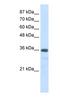 Small Nuclear Ribonucleoprotein U11/U12 Subunit 35 antibody, NBP1-57499, Novus Biologicals, Western Blot image 