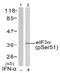 Eukaryotic Translation Initiation Factor 2 Subunit Alpha antibody, AP02522PU-N, Origene, Western Blot image 