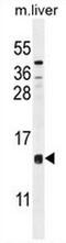 Coiled-Coil Domain Containing 126 antibody, AP50764PU-N, Origene, Western Blot image 