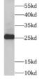Triosephosphate Isomerase 1 antibody, FNab08886, FineTest, Western Blot image 