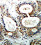 Protein Tyrosine Phosphatase Non-Receptor Type 11 antibody, LS-C335922, Lifespan Biosciences, Immunohistochemistry paraffin image 