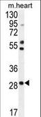 Ring Finger Protein 183 antibody, LS-C162652, Lifespan Biosciences, Western Blot image 
