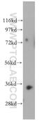Renalase, FAD Dependent Amine Oxidase antibody, 15003-1-AP, Proteintech Group, Western Blot image 