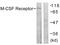 Colony Stimulating Factor 1 Receptor antibody, LS-C117667, Lifespan Biosciences, Western Blot image 