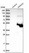 Platelet Activating Factor Acetylhydrolase 2 antibody, NBP1-81687, Novus Biologicals, Western Blot image 